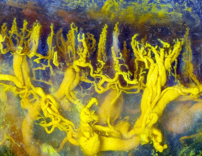 Human Tongue Blood Vessels Injected With Lead Chromate, New York, Honorable Mention
