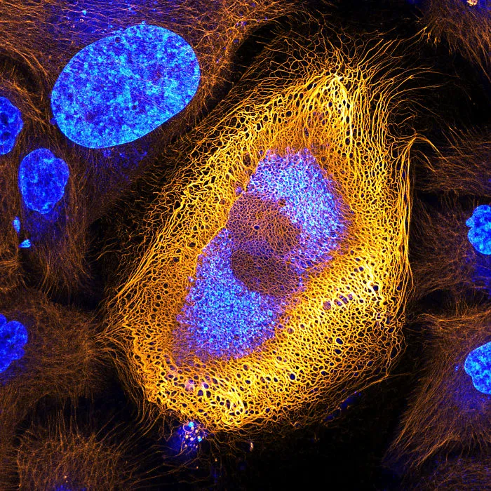 Células de piel humana con la keratina de color fluorescente, Amsterdam, 1º premio