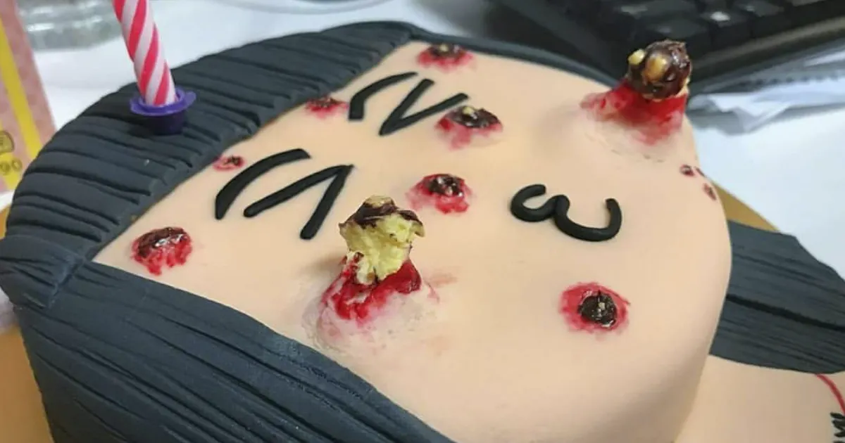 Esta tarta tiene espinillas que puedes reventar, y no podemos dejar de mirar aunque queramos