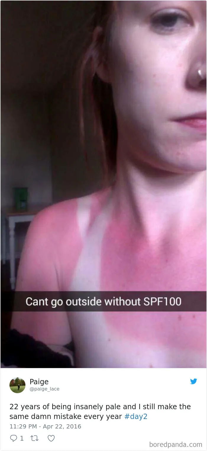 60 Funny Pale People Problems That Other People Will Never Understand