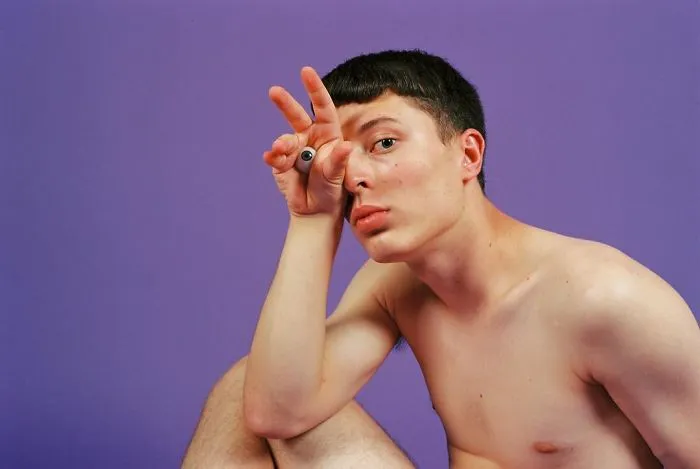 Jordi Had His Eye Removed As A Child Due To A Tumour Growing Behind Him. Today He Uses A Prosthetic Eye