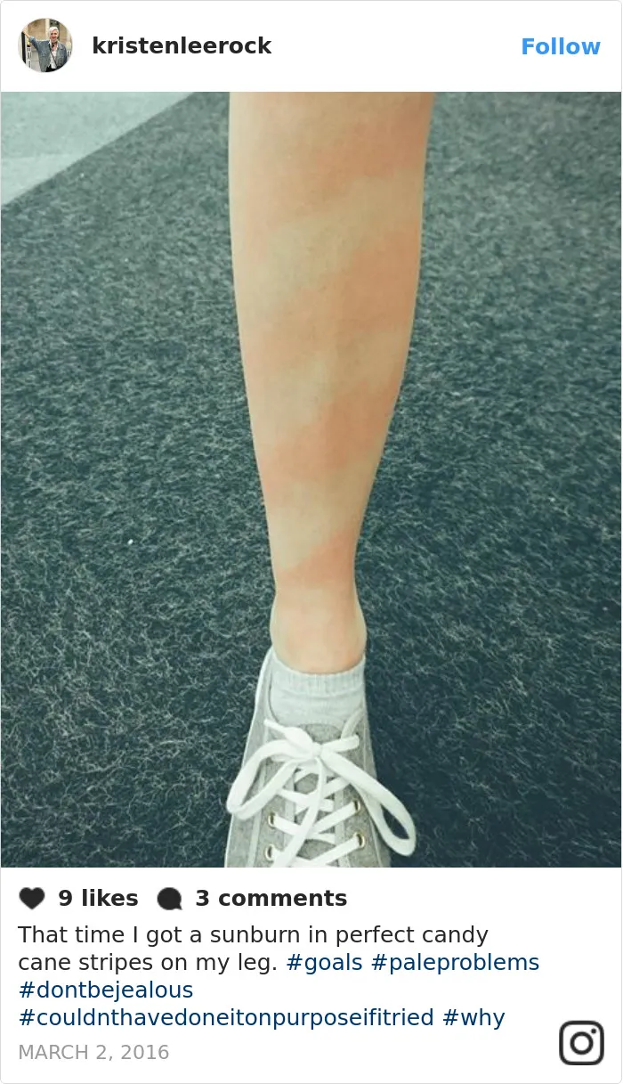 60 Funny Pale People Problems That Other People Will Never Understand