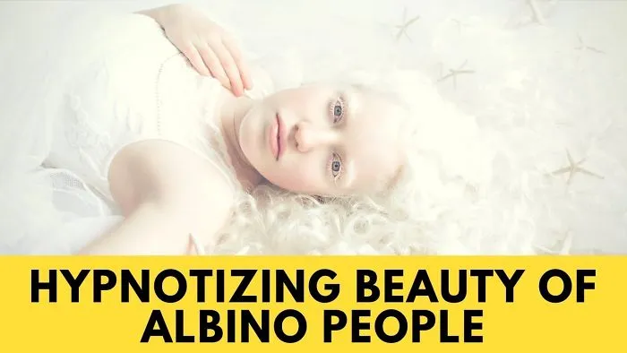 Hypnotizing Beauty Of Albino People