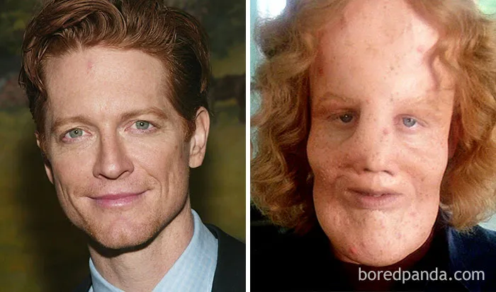 Eric Stoltz - Rocky Dennis (Máscara)