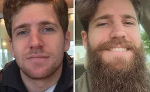 30 Before & After Pics That Will Make You Reconsider Shaving Your Beard