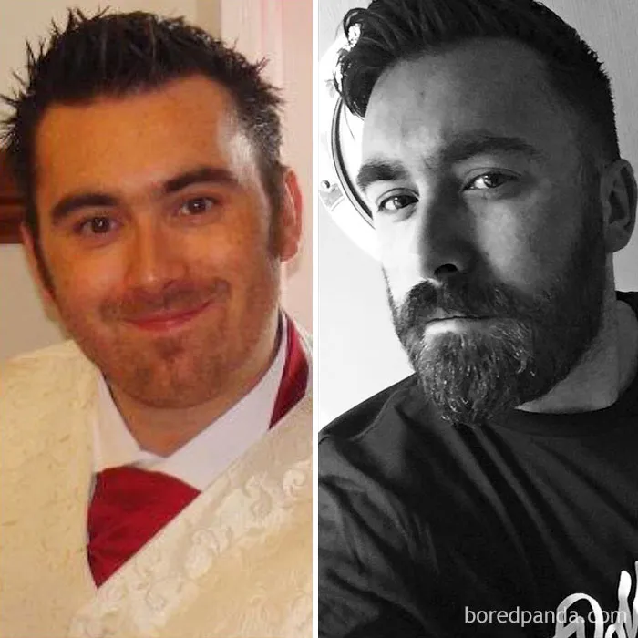 Before And After