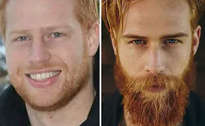 30 Before & After Pics That Will Make You Reconsider Shaving Your Beard