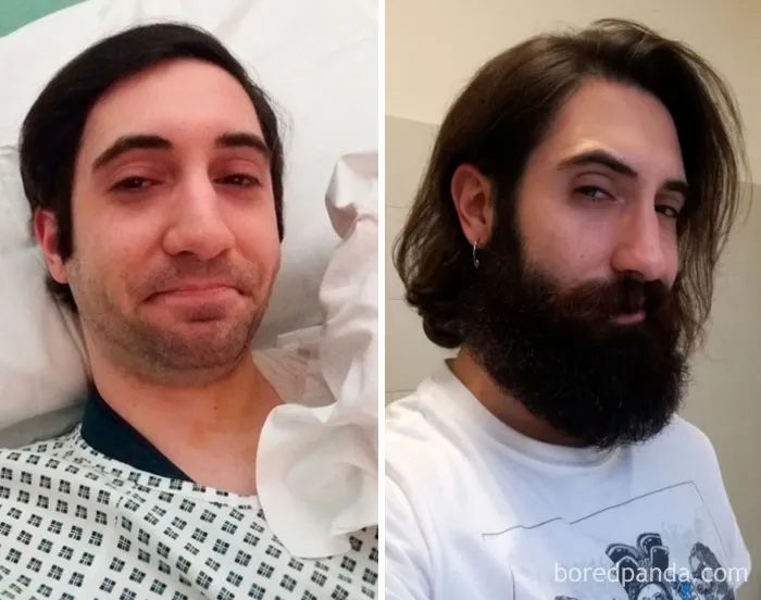 From February Till Today. Please Take Note Of The Extremely Weak Chin
