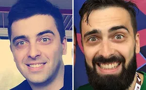 It's No Shave November! Share Your Before And After Pics Of Growing A Beard