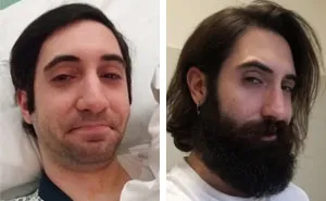 30 Before & After Pics That Will Make You Reconsider Shaving Your Beard