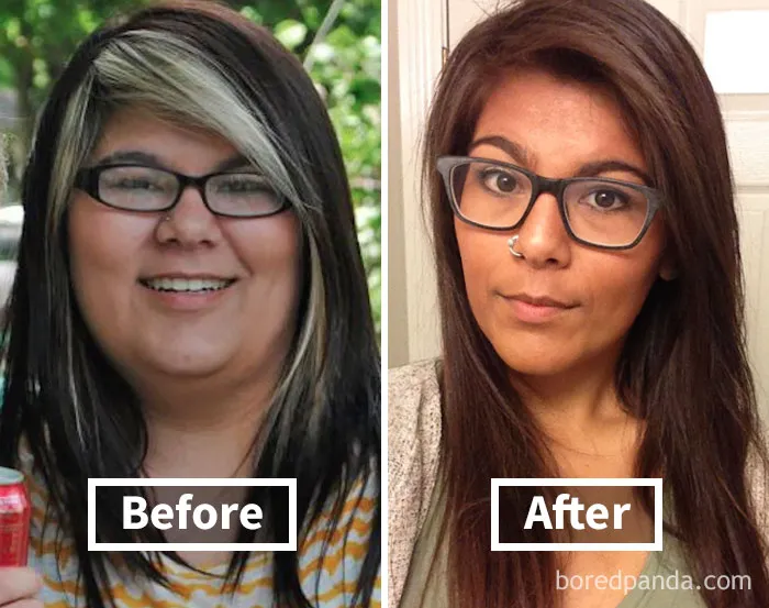 Before and after photos showcasing face fat loss and transformation post weight loss.