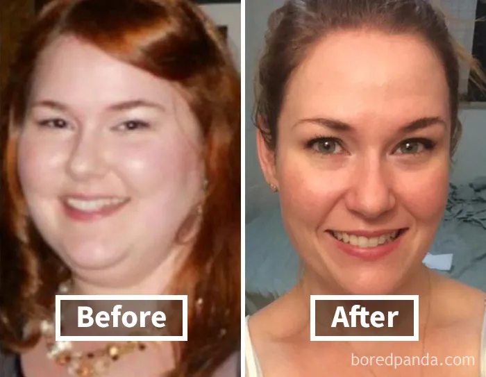 Before and after photos showing face fat loss and weight loss transformation.