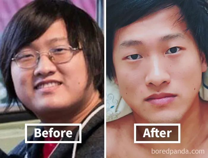 Face fat loss before and after weight loss; comparison of two images side by side.