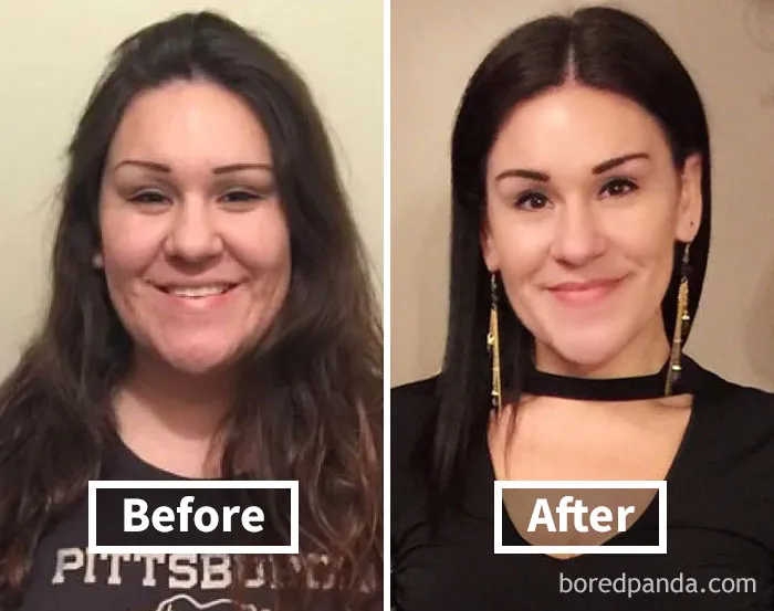 "Face fat loss transformation: woman before and after weight loss with noticeable changes."