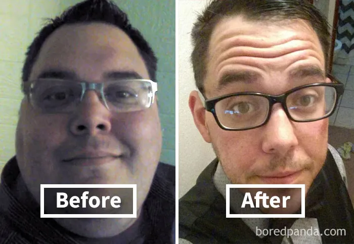 Before and after face fat loss transformation, highlighting noticeable changes in appearance.