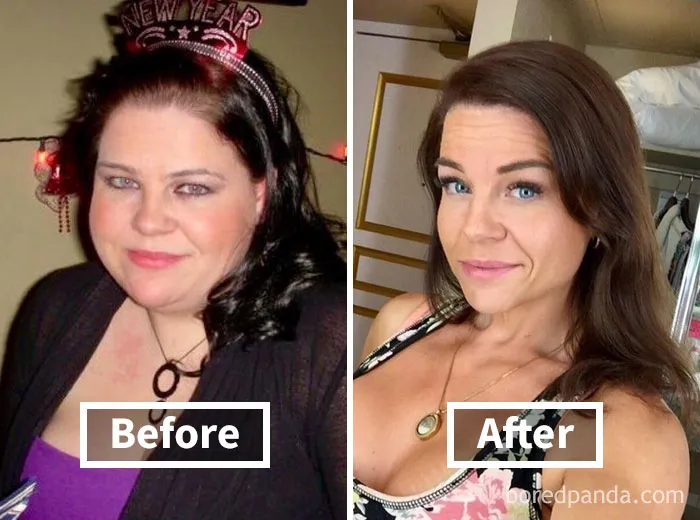 Face fat loss transformation, showing a before and after weight loss comparison.