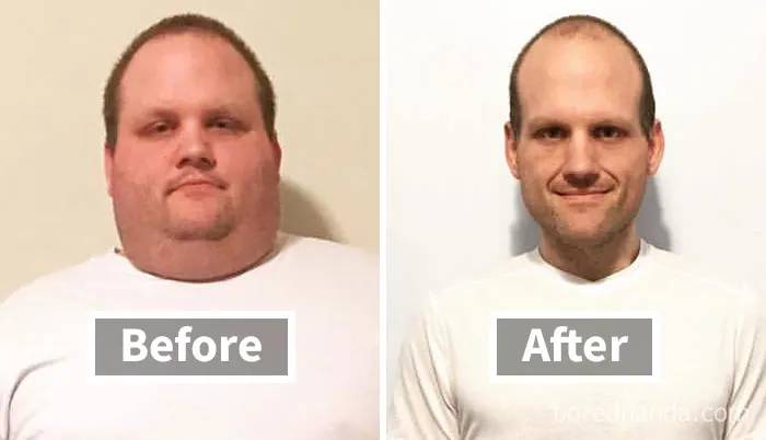 Face fat loss shown in before and after weight loss photo, with noticeable changes in appearance.