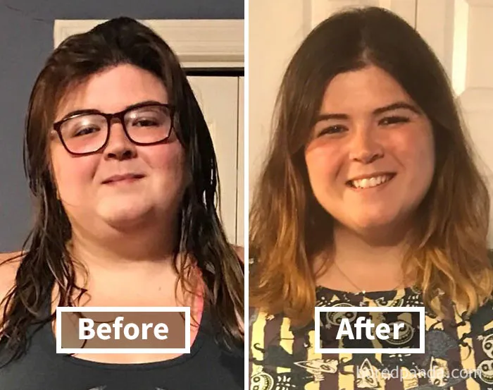Before and after photos illustrating face fat loss following weight loss transformation.