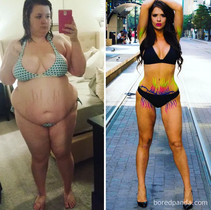 Christine perdió 79 kilos y aprendió a amar sus estrías