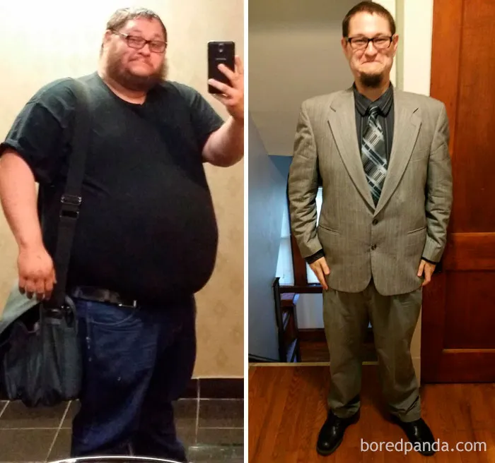 He perdido 90 kilos en el último año, gracias al ejercicio y una operación de banda gástrica