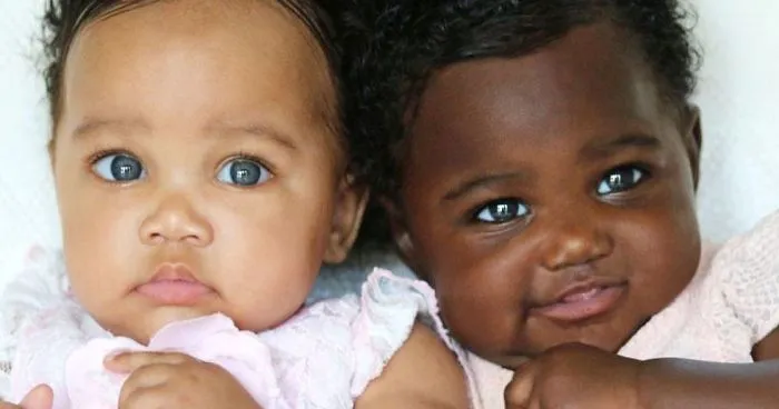 Girls Born In Different Colors Make It Nearly Impossible To Tell They Are Twins