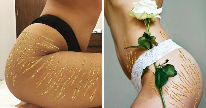 Artist Turns Stretch Marks Into Art In Order To Encourage People To Be Proud Of Them