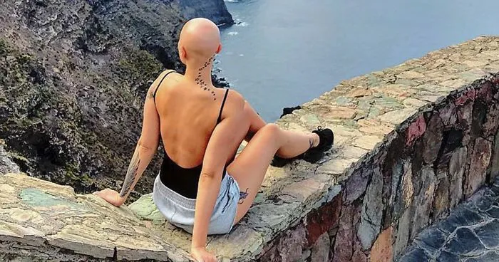 Woman Reveals Her 'Big Secret' She Was Hiding Under The Wig For Years, And Becomes A Model