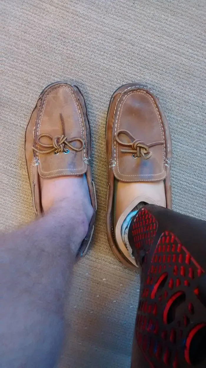 La diferencia tras un año entre el zapato normal y el de la prótesis