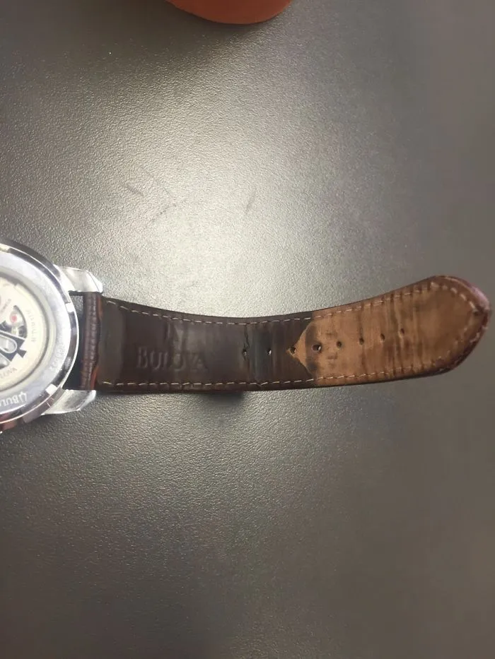 Where My Skin Has And Has Not Touched The Band Of My Watch Over The Last 2 Years