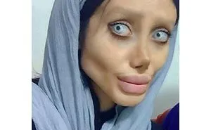 Woman Does 50 Plastic Surgeries To Stay The Same Angelina Jolie And Has A Negative Return On The Internet