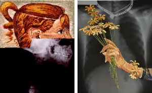 Artist Embroiders X-Rays And It's Beautiful And Creepy At The Same Time