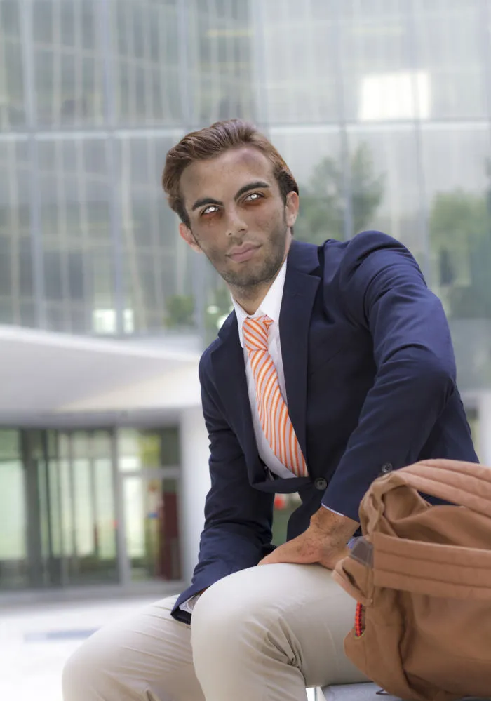 A man in a suit is sitting his eyes are white and his face is tanned badly