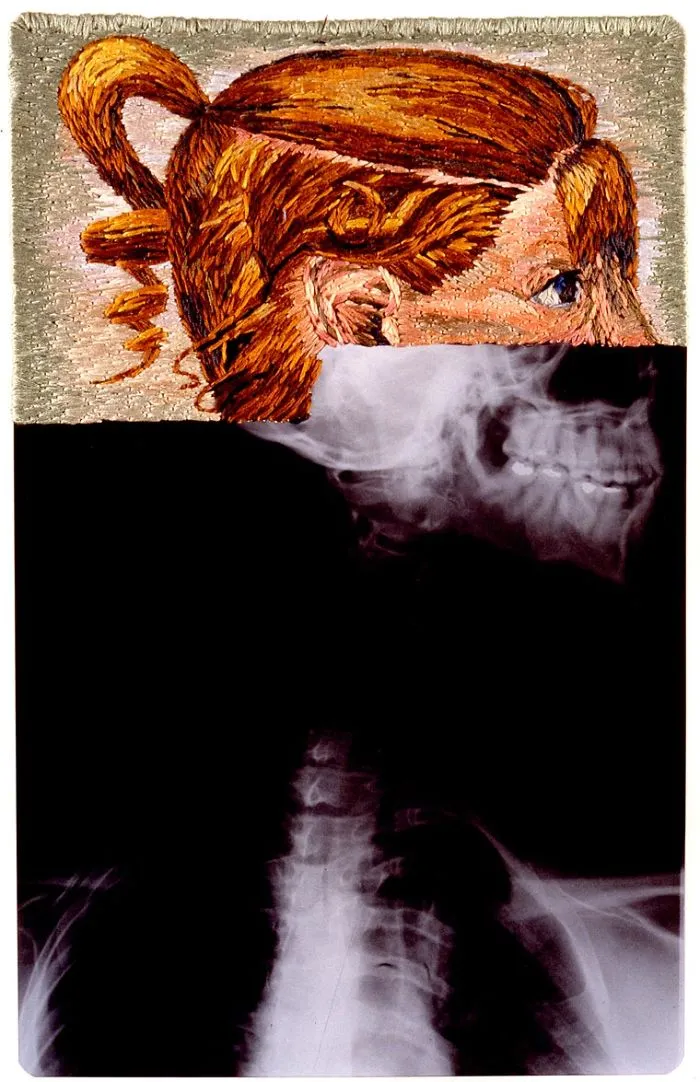 Artist Embroiders X-Rays And It's Beautiful And Creepy At The Same Time