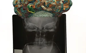 Artist Embroiders X-Rays And It's Beautiful And Creepy At The Same Time