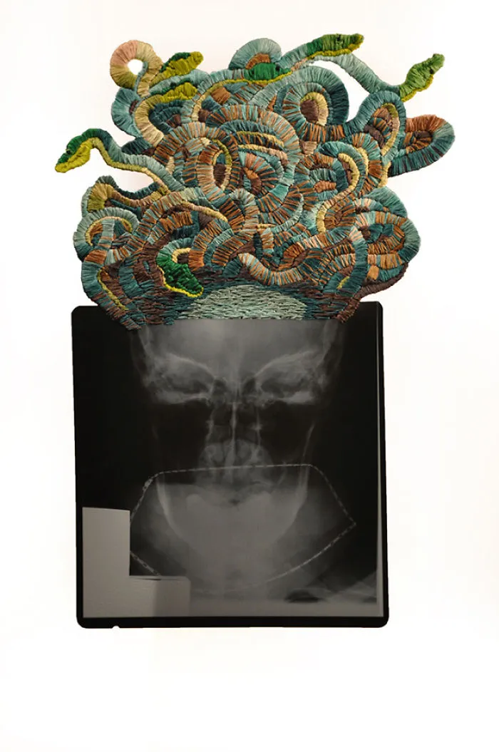 Artist Embroiders X-Rays And It's Beautiful And Creepy At The Same Time