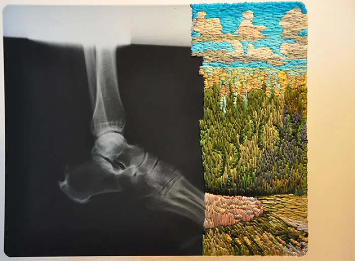 Artist Embroiders X-Rays And It's Beautiful And Creepy At The Same Time