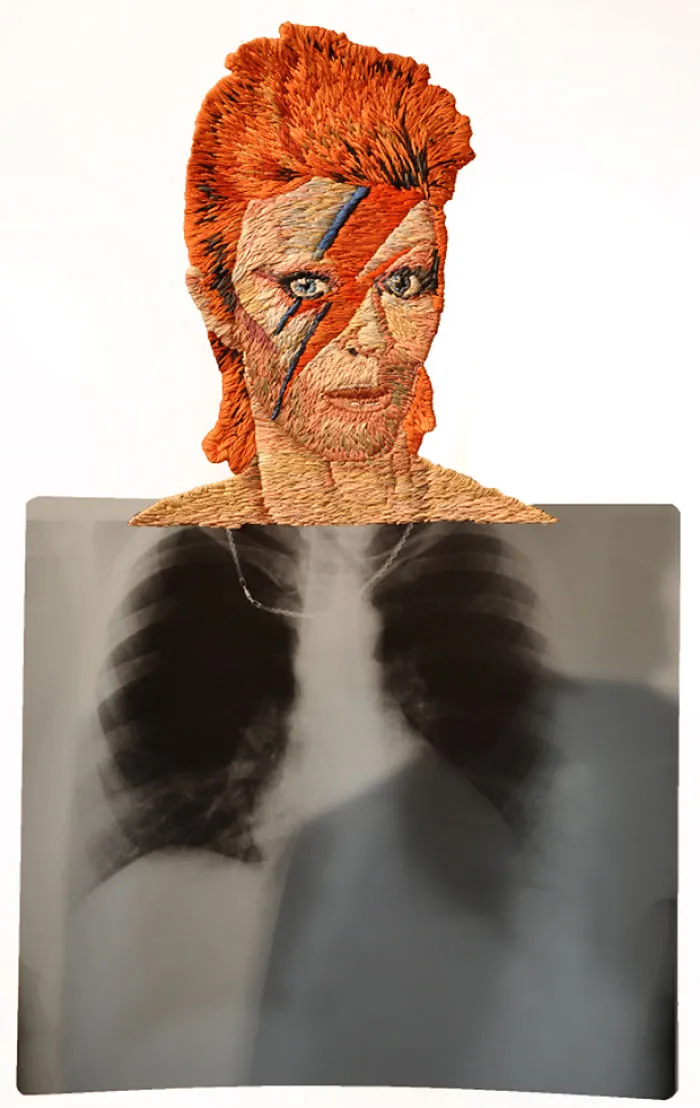 Artist Embroiders X-Rays And It's Beautiful And Creepy At The Same Time