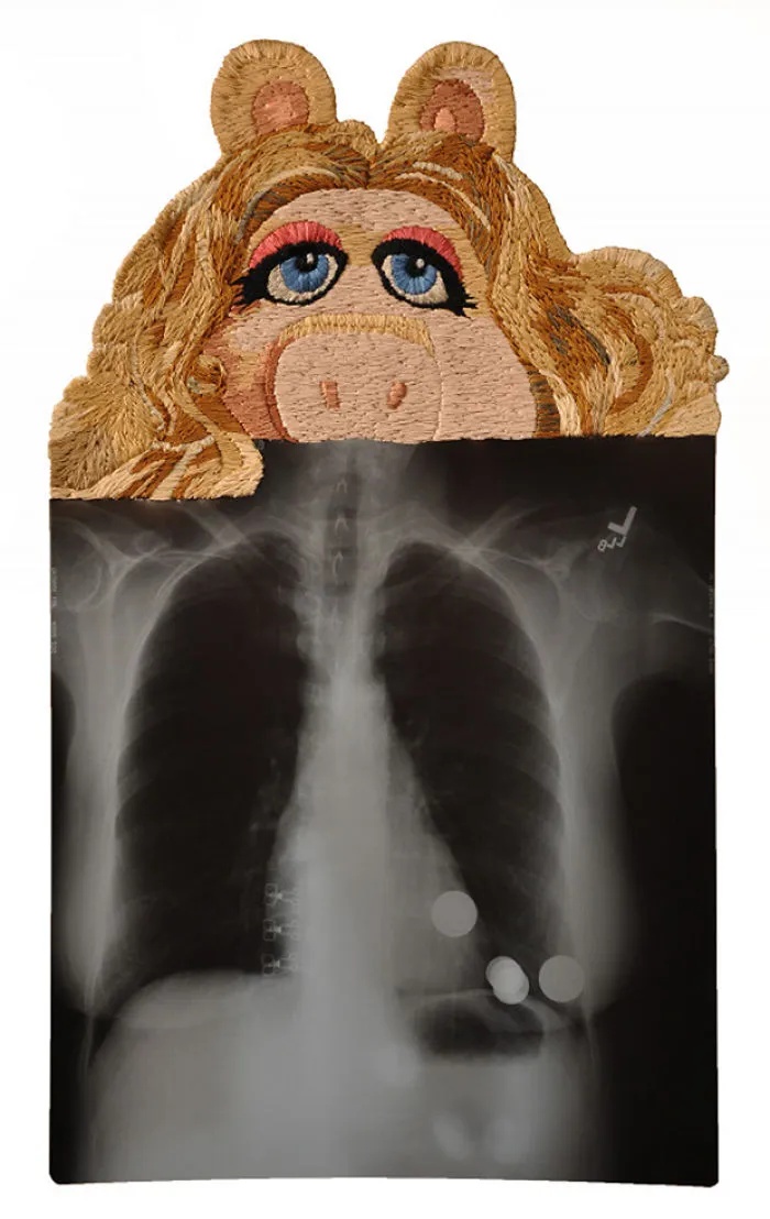 Artist Embroiders X-Rays And It's Beautiful And Creepy At The Same Time