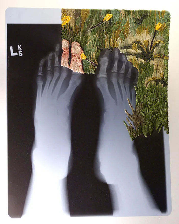 Artist Embroiders X-Rays And It's Beautiful And Creepy At The Same Time
