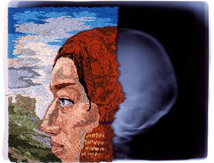 Artist Embroiders X-Rays And It's Beautiful And Creepy At The Same Time