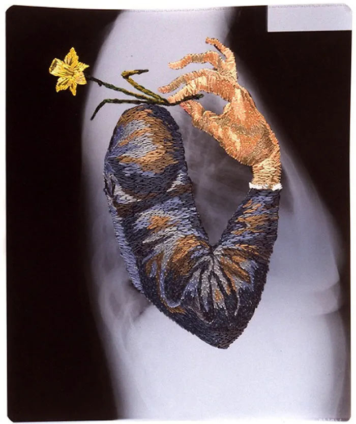 Artist Embroiders X-Rays And It's Beautiful And Creepy At The Same Time