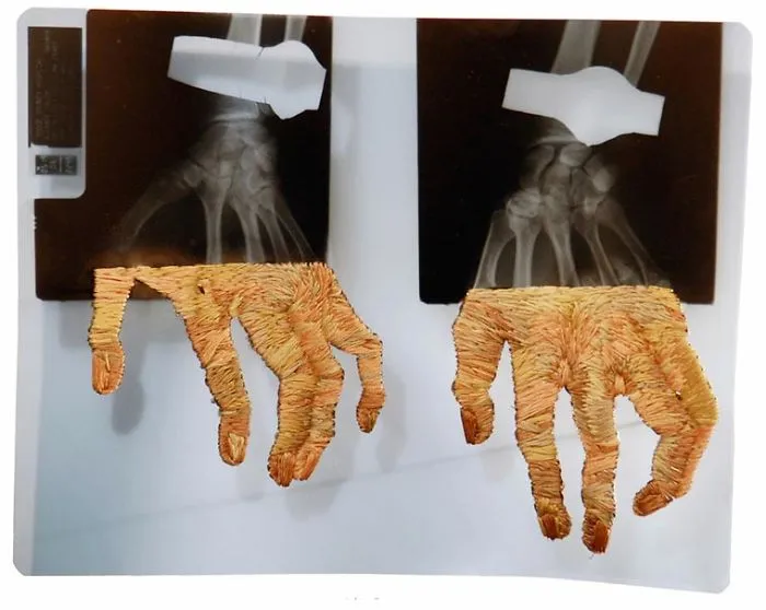 Artist Embroiders X-Rays And It's Beautiful And Creepy At The Same Time