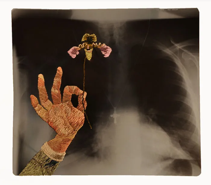 Artist Embroiders X-Rays And It's Beautiful And Creepy At The Same Time