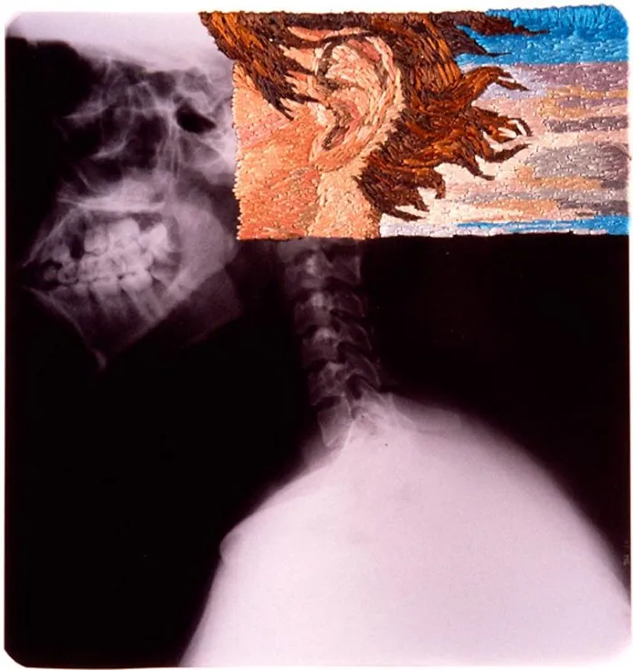 Artist Embroiders X-Rays And It's Beautiful And Creepy At The Same Time