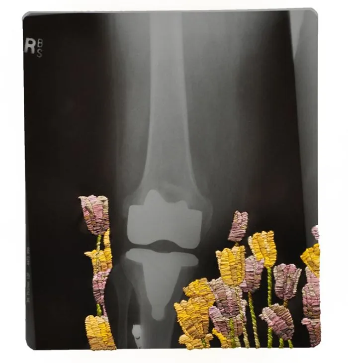 Artist Embroiders X-Rays And It's Beautiful And Creepy At The Same Time