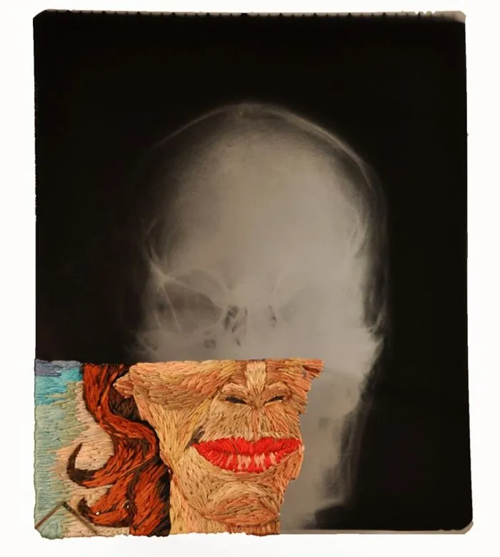 Artist Embroiders X-Rays And It's Beautiful And Creepy At The Same Time