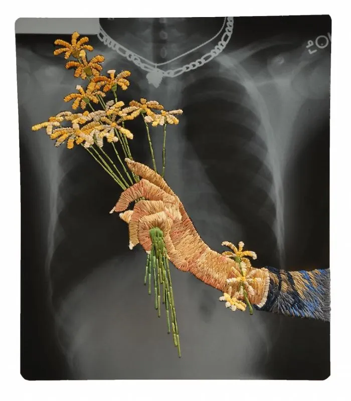 Artist Embroiders X-Rays And It's Beautiful And Creepy At The Same Time