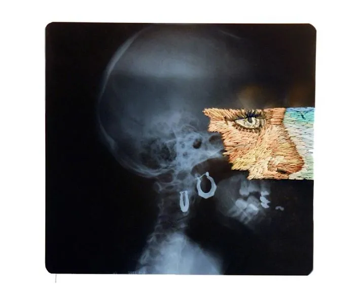 Artist Embroiders X-Rays And It's Beautiful And Creepy At The Same Time