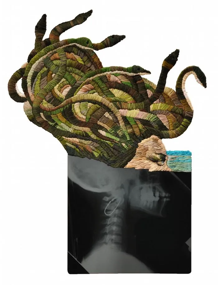 Artist Embroiders X-Rays And It's Beautiful And Creepy At The Same Time
