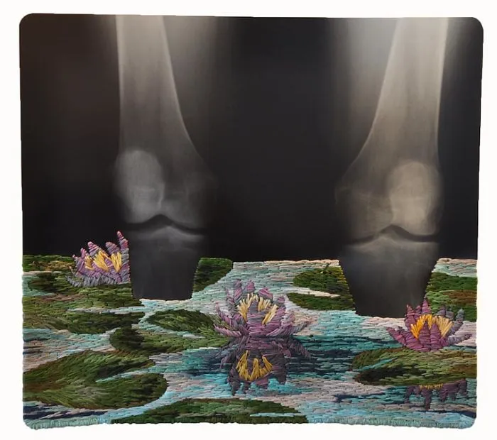Artist Embroiders X-Rays And It's Beautiful And Creepy At The Same Time